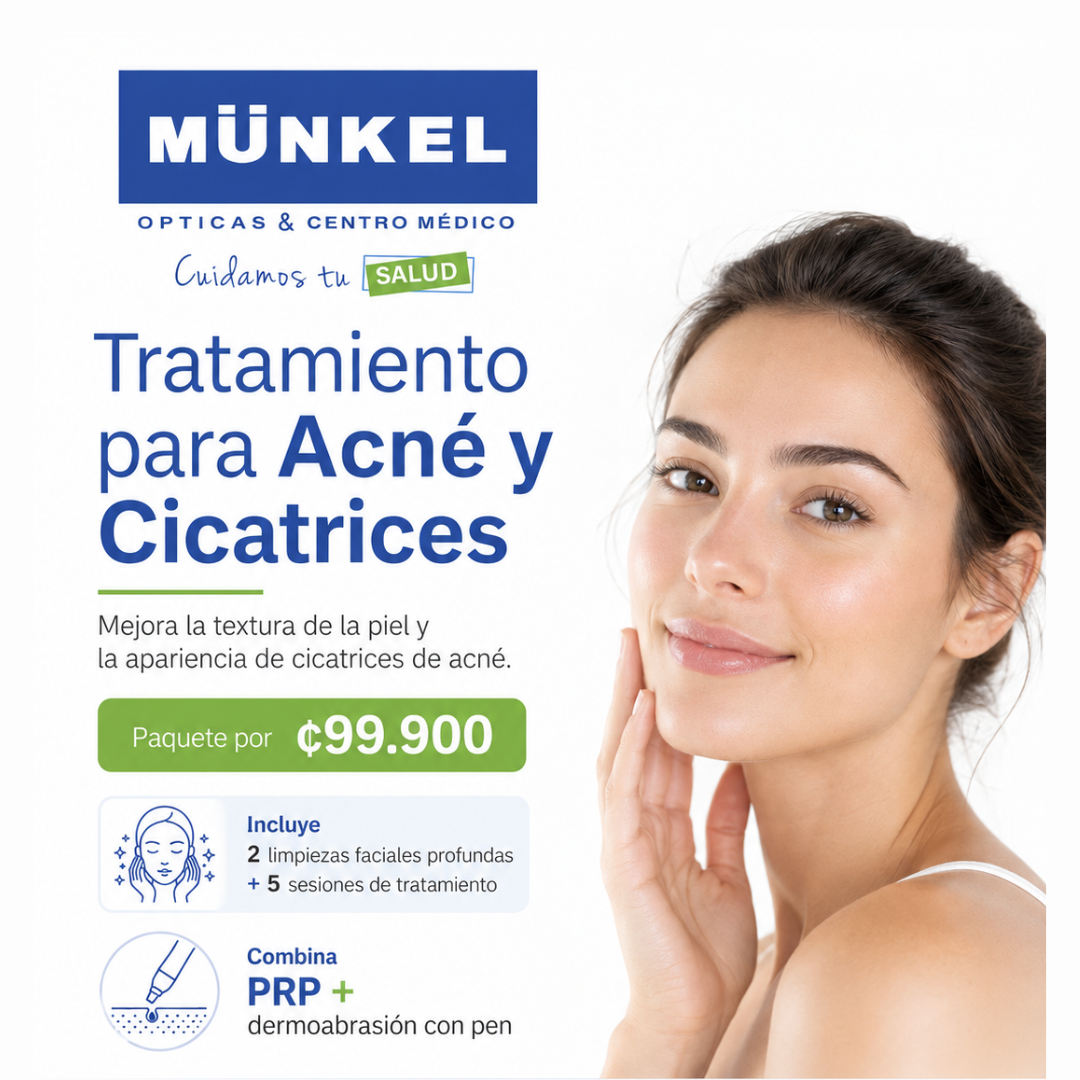 Tratamiento para acné y cicatrices en Centro Médico Munkel con paquete por ₡99.900.
